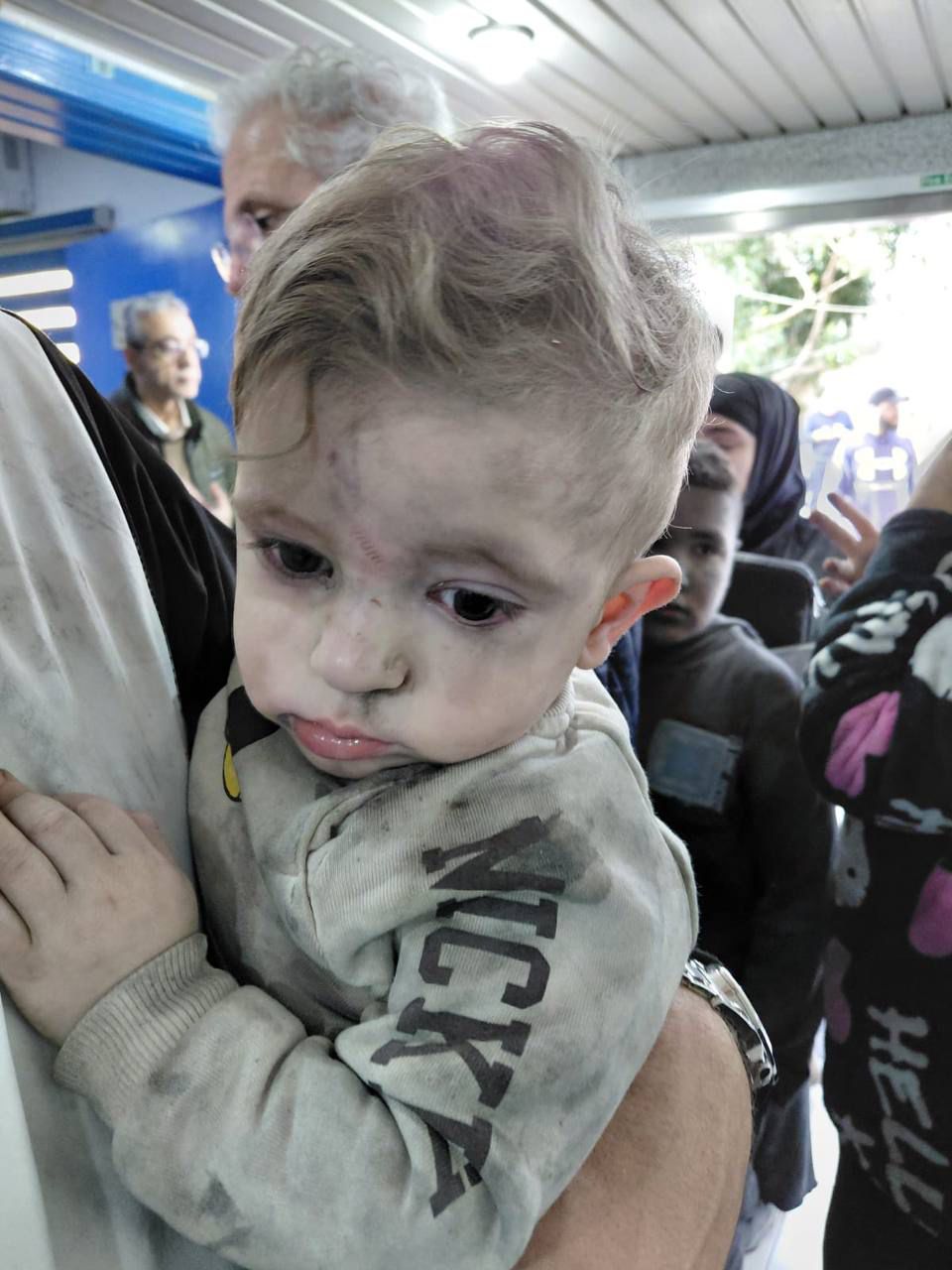 هذا الطفل متواجد في مستشفى جنبلاط ب شويفات